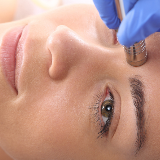 best-microdermabrasion-chicago-il