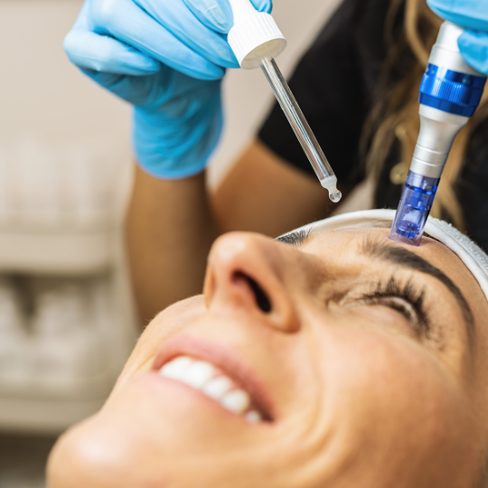 microneedling-chicago-il