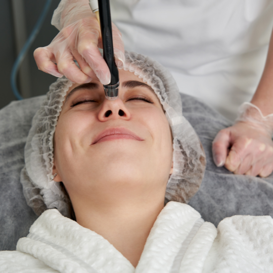 microdermabrasion-chicago-il