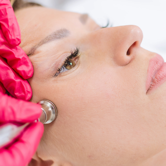 microdermabrasion-in-chicago-il