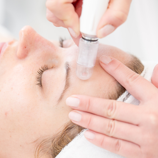 microdermabrasion-in-chicago-ilinois