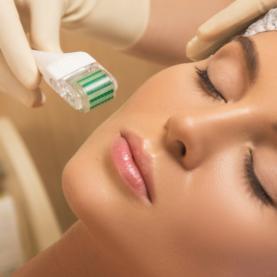 microneedling-in-chicago-il