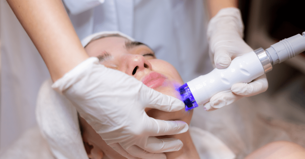 dermarolling the new trend in skincare you need to know about (1)