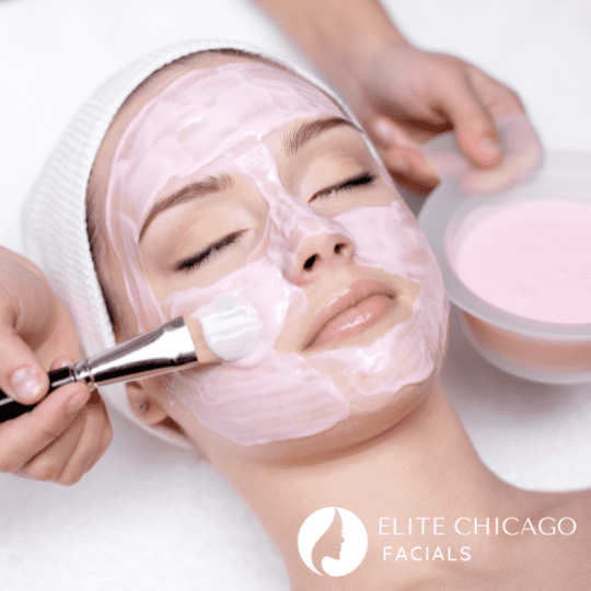 IL Chemical Peels Chicago