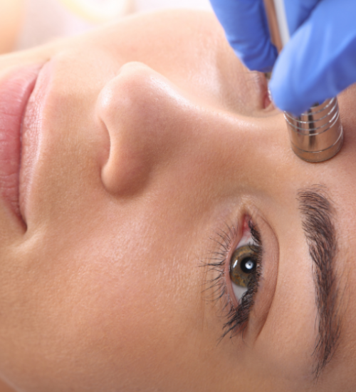 Best Microdermabrasion Chicago IL