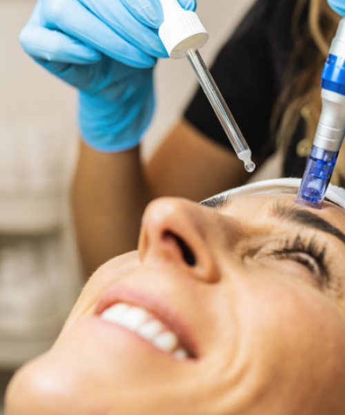 MICRONEEDLING CHICAGO IL