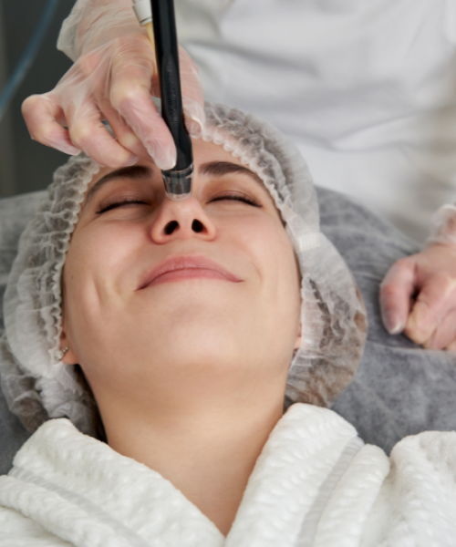 Microdermabrasion Chicago IL