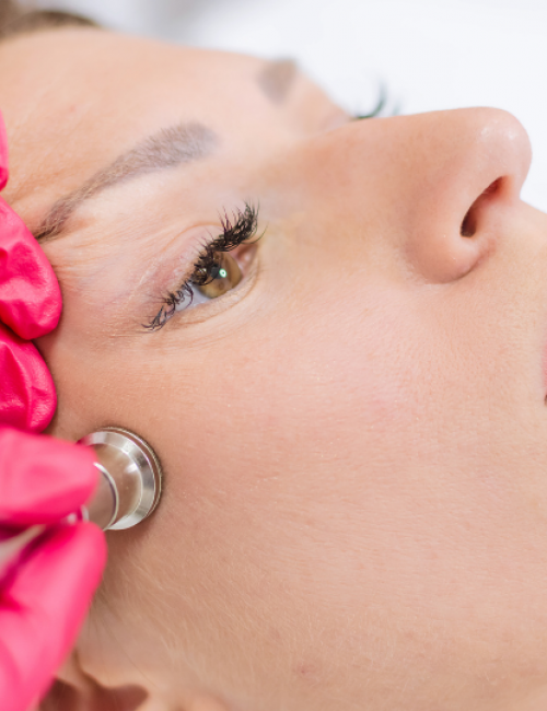 Microdermabrasion in Chicago IL