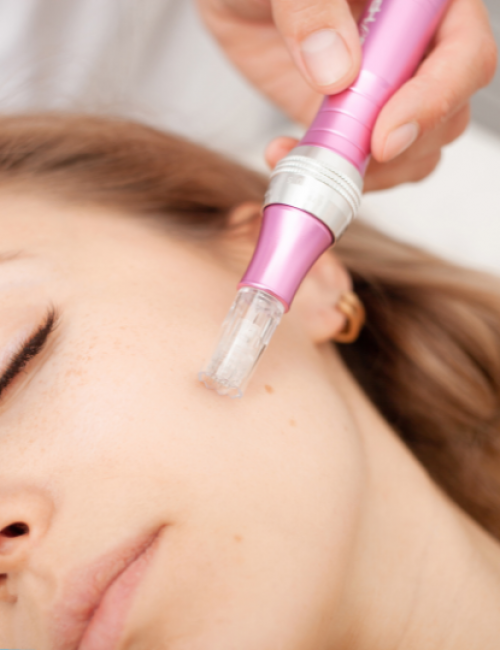 Microneedling Chicago IL