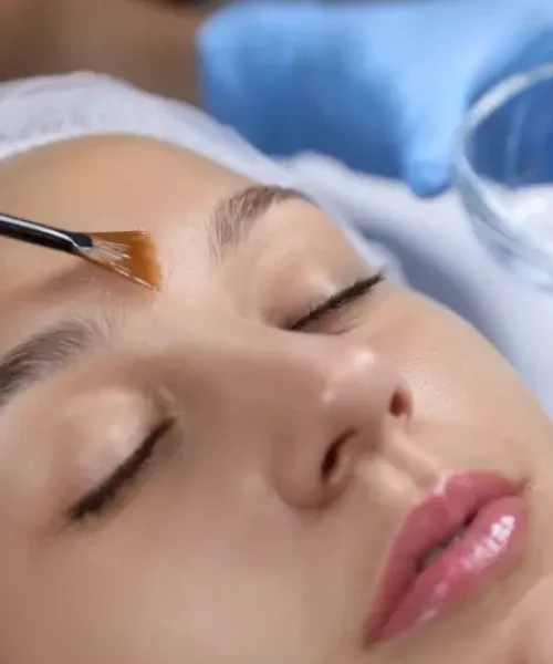 microdermabrasion west loop il elite chicago facials