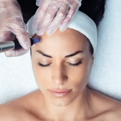 microneedling forest park il elite chicago facials